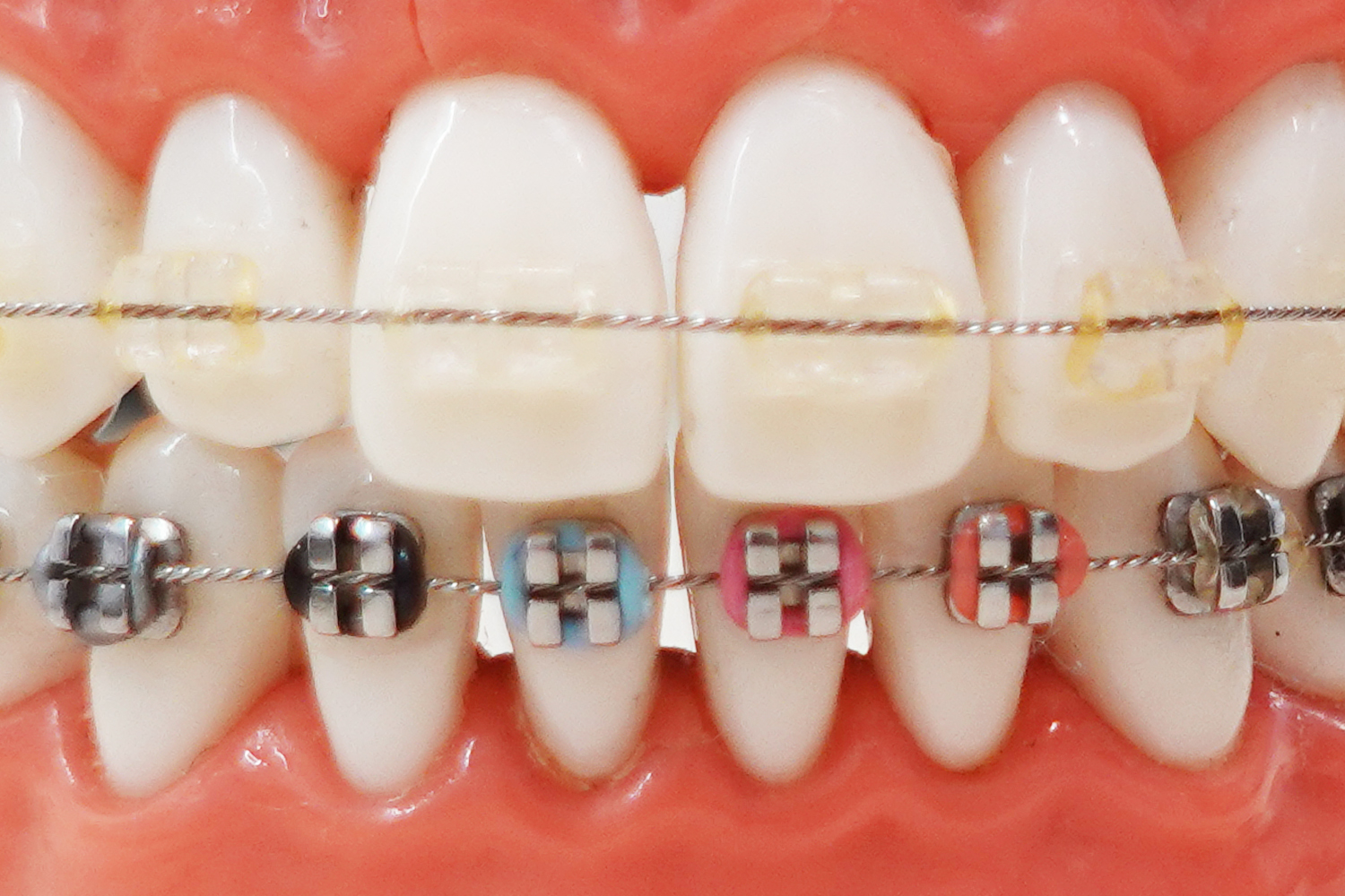 Ortho Center Orthodontist Hong Kong, Dental Services