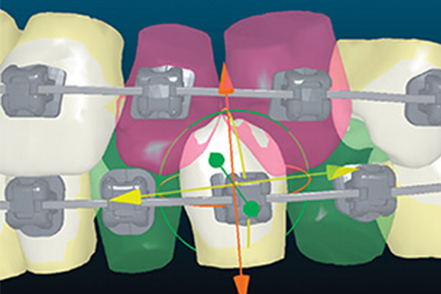 Ortho Center Orthodontist Hong Kong, Dental Services